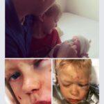 Bridger-Walker-Injury